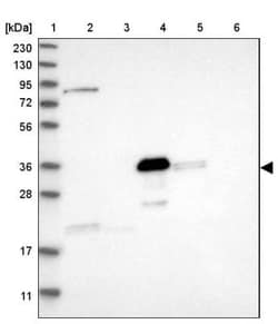 DDHD2 Antibody, Novus Biologicals:Antibodies:Primary Antibodies