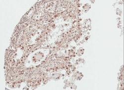 DDI1 Antibody, Novus Biologicals 0.1mg; Unlabeled:Antibodies, Polyclonal