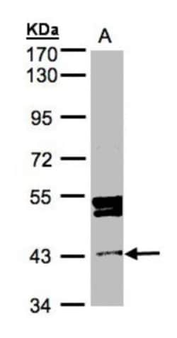 DDI1 Antibody, Novus Biologicals 0.1mg; Unlabeled:Antibodies, Polyclonal