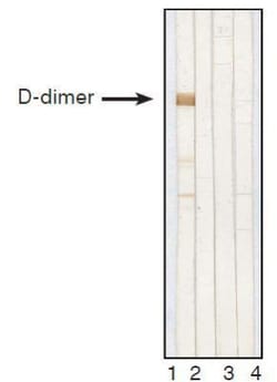 D-Dimer Antibody (DD1), Novus Biologicals 0.2mg; Unlabeled:Antibodies,