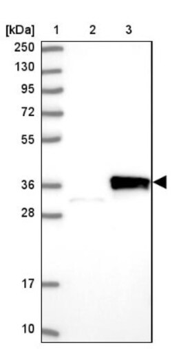 DDIT4 Antibody, Novus Biologicals 0.1mL; Unlabeled:Antibodies, Polyclonal
