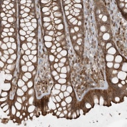 DDIT4 Antibody, Novus Biologicals 0.1mL; Unlabeled:Antibodies, Polyclonal