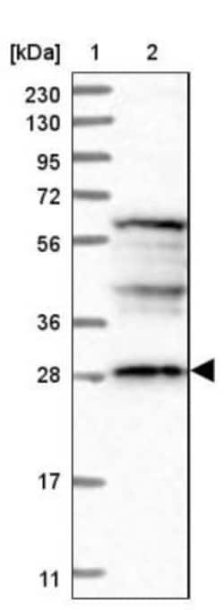 DDO Antibody, Novus Biologicals 25 &mu;L; Unlabeled:Antibodies, Polyclonal