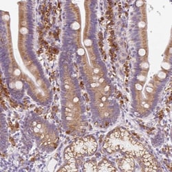 DDOST Antibody, Novus Biologicals 25 &mu;L, Unlabeled:Antibodies, Polyclonal