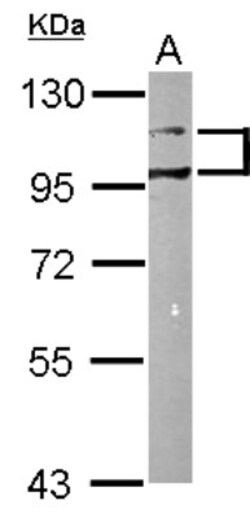 DDR1 Antibody, Novus Biologicals 0.1mg; Unlabeled:Antibodies, Polyclonal