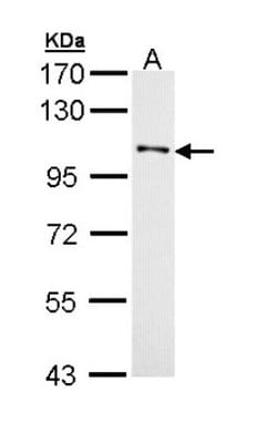 DDR1 Antibody, Novus Biologicals 0.1mg; Unlabeled:Antibodies, Polyclonal