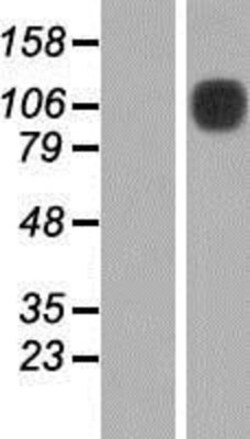 Novus Biologicals&trade;&nbsp;DDR1 Overexpression Lysate