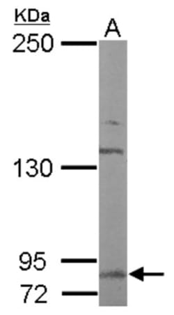 DDR2 Antibody, Novus Biologicals 0.1mL; Unlabeled:Antibodies, Polyclonal