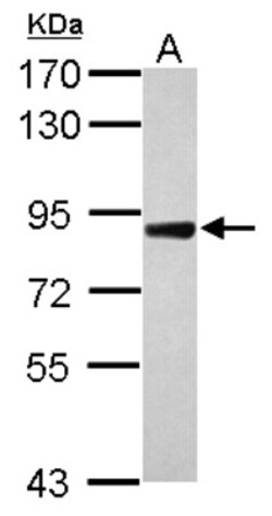 DDR2 Antibody, Novus Biologicals 0.1mL; Unlabeled:Antibodies, Polyclonal