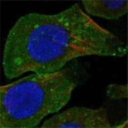 DDR2 Antibody (3B11E4), Novus Biologicals 0.1mL; Unlabeled:Antibodies,