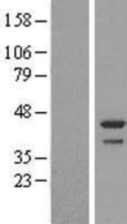 Novus Biologicals&trade;&nbsp;DDRGK1 Overexpression Lysate