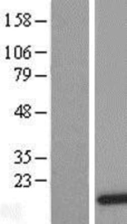 Novus Biologicals&trade;&nbsp;DDT Overexpression Lysate