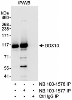 DDX10 Antibody, Novus Biologicals 0.1mg; Unlabeled:Antibodies, Polyclonal