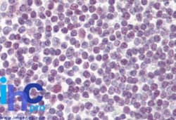 DDX18 Antibody, Novus Biologicals:Antibodies:Primary Antibodies