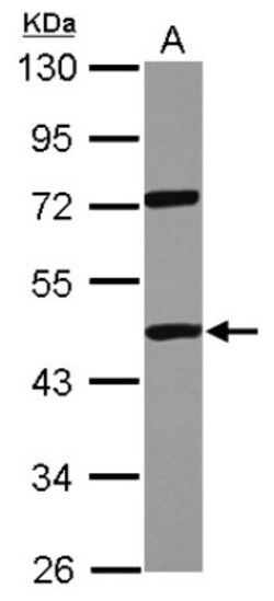 DDX19A Antibody, Novus Biologicals 0.1mL; Unlabeled:Antibodies, Polyclonal