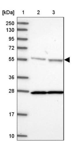 DDX19A Antibody, Novus Biologicals 0.1mL; Unlabeled:Antibodies, Polyclonal