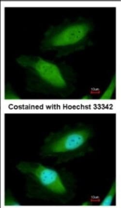 DDX19B Antibody, Novus Biologicals 0.1mL; Unlabeled:Antibodies, Polyclonal