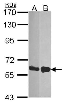 DDX19B Antibody, Novus Biologicals 0.1mL; Unlabeled:Antibodies, Polyclonal