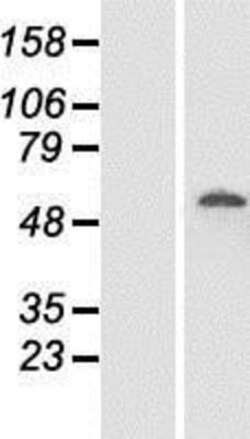 Novus Biologicals&trade;&nbsp;DDX19B Overexpression Lysate