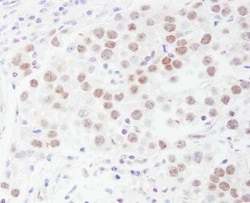 DDX1 Antibody, Novus Biologicals 0.1mL; Unlabeled:Antibodies, Polyclonal