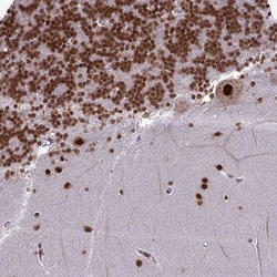 DDX1 Antibody, Novus Biologicals 25 &mu;L; Unlabeled:Antibodies, Polyclonal