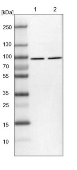 DDX1 Antibody, Novus Biologicals 25 &mu;L; Unlabeled:Antibodies, Polyclonal