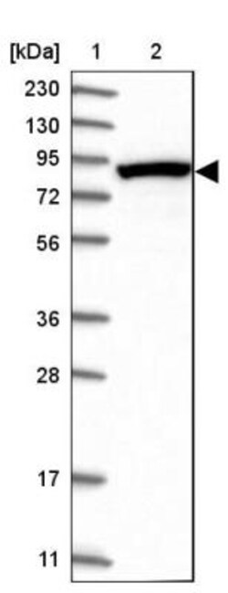 DDX1 Antibody, Novus Biologicals 25 &mu;L; Unlabeled:Antibodies, Polyclonal