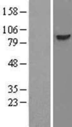 Novus Biologicals&trade;&nbsp;DDX21 Overexpression Lysate