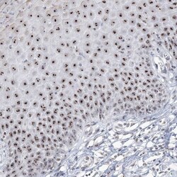 DDX21 Antibody, Novus Biologicals 0.1mL; Unlabeled:Antibodies, Polyclonal