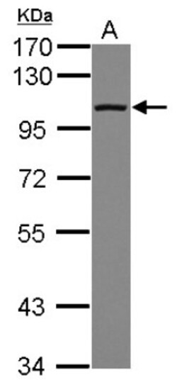 DDX23 Antibody, Novus Biologicals 0.1mL; Unlabeled:Antibodies, Polyclonal