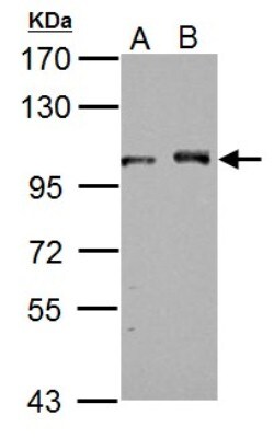 DDX23 Antibody, Novus Biologicals 0.1mL; Unlabeled:Antibodies, Polyclonal