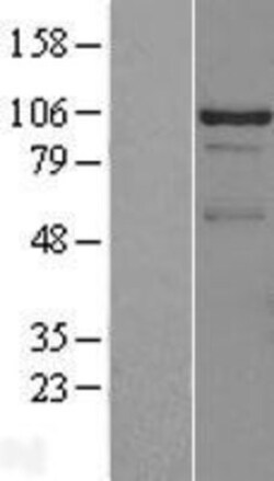 Novus Biologicals&trade;&nbsp;DDX23 Overexpression Lysate