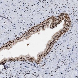 DDX23 Antibody, Novus Biologicals 25 &mu;L; Unlabeled:Antibodies, Polyclonal