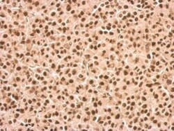 DDX23 Antibody, Novus Biologicals 0.1mL; Unlabeled:Antibodies, Polyclonal