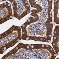 DDX24 Antibody, Novus Biologicals 25 &mu;L; Unlabeled:Antibodies, Polyclonal