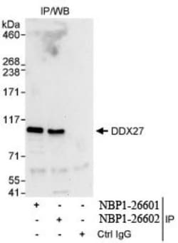 DDX27 Antibody, Novus Biologicals 0.1mg; Unlabeled:Antibodies, Polyclonal