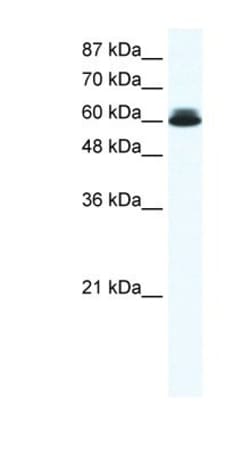 DDX27 Antibody, Novus Biologicals 100&mu;L; Unlabeled:Antibodies, Polyclonal