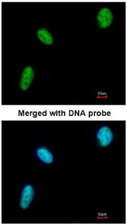 DDX39 Antibody, Novus Biologicals 0.1mL; Unlabeled:Antibodies, Polyclonal