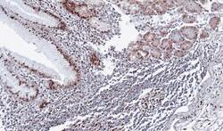 DDX39 Antibody, Novus Biologicals 0.1mL; Unlabeled:Antibodies, Polyclonal