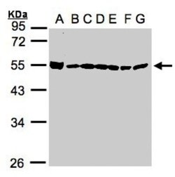 DDX39 Antibody, Novus Biologicals 0.1mL; Unlabeled:Antibodies, Polyclonal