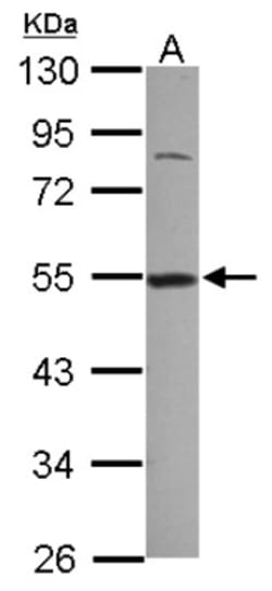 DDX39 Antibody, Novus Biologicals 0.1mL; Unlabeled:Antibodies, Polyclonal