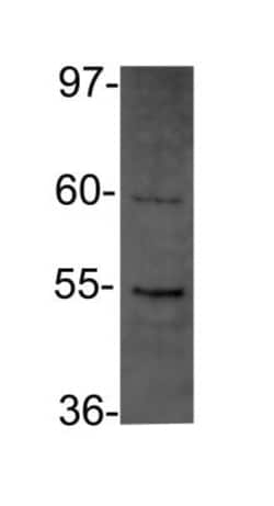 DDX39 Antibody, Novus Biologicals 0.1mL; Unlabeled:Antibodies, Polyclonal