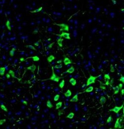DDX3 Antibody, Novus Biologicals 0.1mL; Unlabeled:Antibodies, Polyclonal
