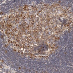 DDX3 Antibody, Novus Biologicals 0.1mL; Unlabeled:Antibodies, Polyclonal