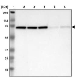DDX3 Antibody, Novus Biologicals 0.1mL; Unlabeled:Antibodies, Polyclonal
