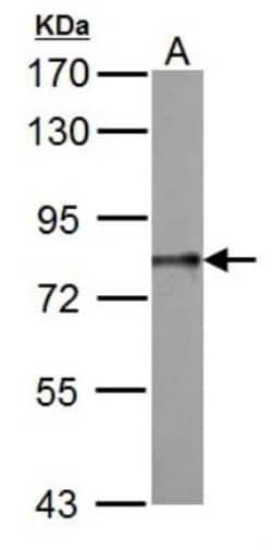 DDX3 Antibody, Novus Biologicals 0.1mL; Unlabeled:Antibodies, Polyclonal