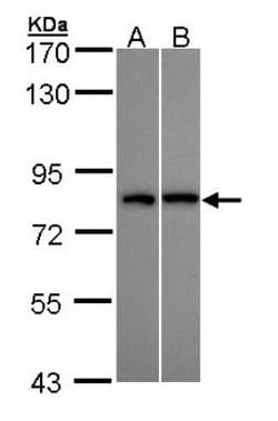 DDX3 Antibody, Novus Biologicals 0.1mL; Unlabeled:Antibodies, Polyclonal