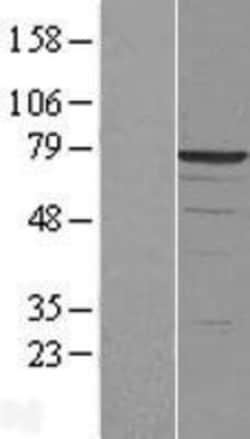 Novus Biologicals&trade;&nbsp;DDX41 Overexpression Lysate