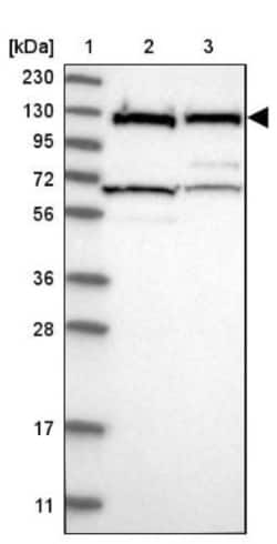 DDX42 Antibody, Novus Biologicals:Antibodies:Primary Antibodies