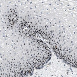 DDX47 Antibody, Novus Biologicals 0.1mL; Unlabeled:Antibodies, Polyclonal